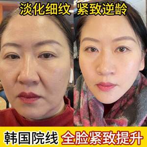 【双11返场】提拉紧致线膜胶原蛋白面膜抗皱淡纹V脸淡化法令纹