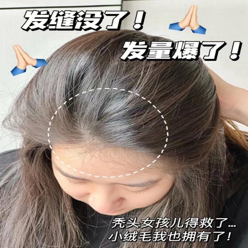 【德国新技术】长发液防脱发液防脱增发密发固发发际线快速增长液