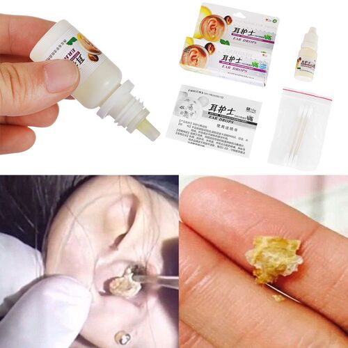 15ml/bottle Ear Liquid Acute Otitis Drops Chinese Herbal Me