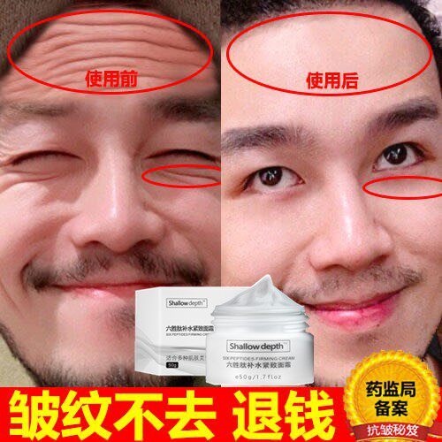 除皱纹男士纹克星去皱额头抗皱去皱化妆品神器除邹纹保湿去皱