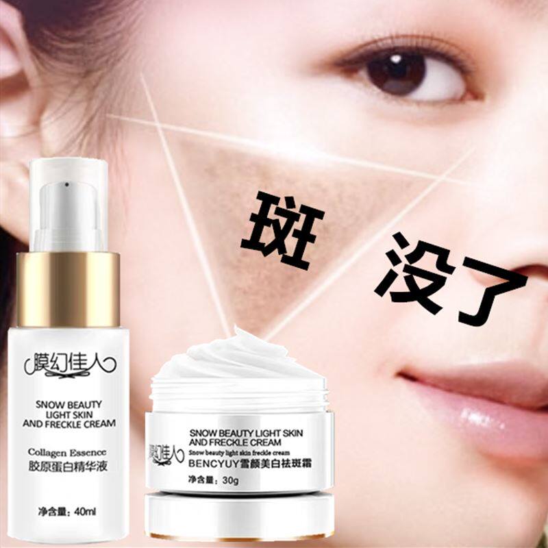 贵妇祛斑霜正品祛斑美白淡化色斑祛雀斑黄褐斑老年斑晒斑去斑神器