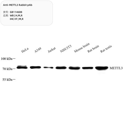 Servicebio  抗METTL3兔单克隆抗体，GB114688，100μL