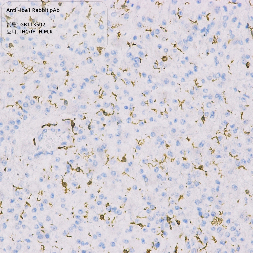 抗-Iba1兔pAb抗体,适用IHC/IF,种属H/M/R/Mk,小胶质细胞/推荐抗体