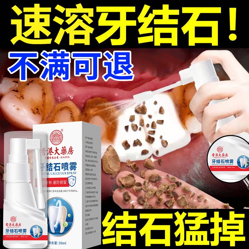 香港牙结石型口腔喷雾溶解牙齿美白牙垢去黄牙茶渍口臭非速效洗白