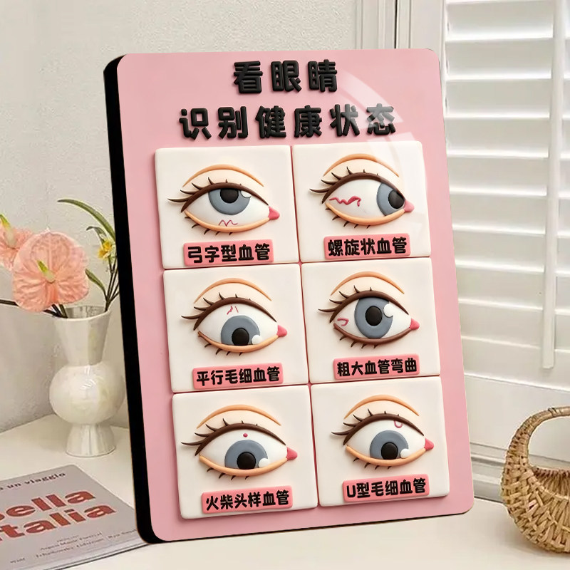 眼诊健康科普画框六种眼白血管图解护眼店理疗馆前台桌面摆件相框