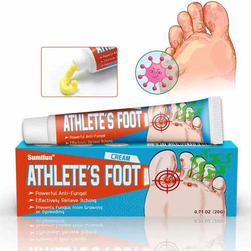 Athletes Foot Cream Effectively Relieve Itching