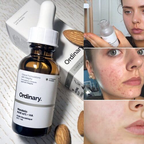 30ml Women Facial Essence Serum AHA 30% + BHA 2% Exfoliating