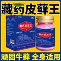 藏药皮癣王牛皮药膏头皮股银去屑病皮肤杀菌症止痒抑菌正品专用癣
