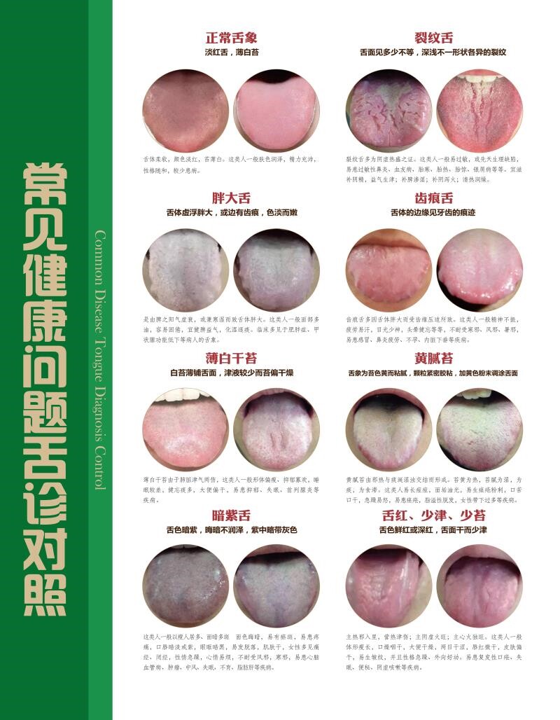 常见健康问题舌诊对照海报展板舌诊基础知识挂图装饰画墙贴墙纸