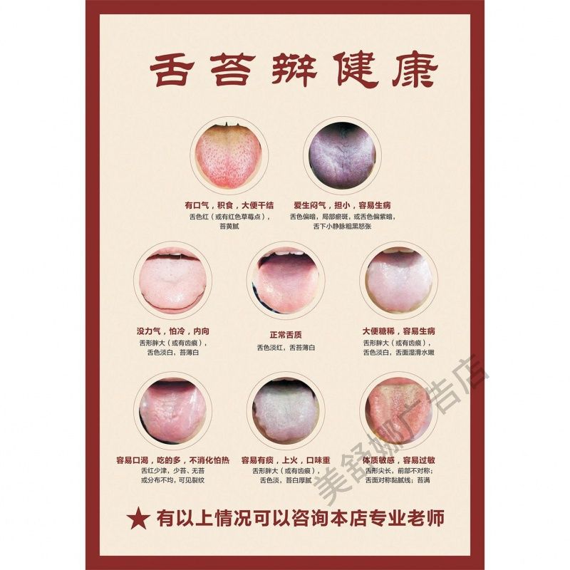 中医舌苔辩健康海报诊面自粘图解舌苔对照图彩图版中医舌诊挂图