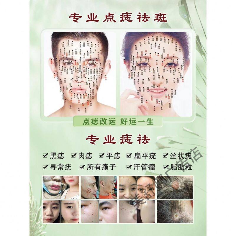 专业点痣宣传广告男女面痣图贴纸点痣广告图祛斑点疣去痣海报墙贴