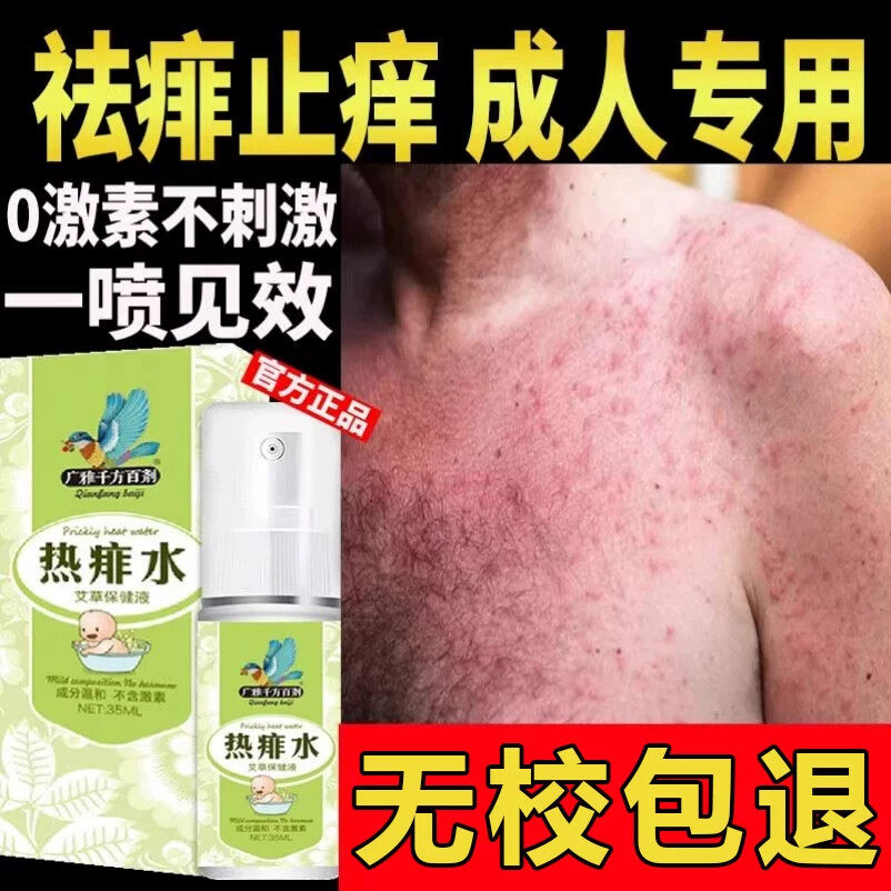 痱子止痒水成人去痱子喷雾液体祛痱膏治除热痱子水大人防菲神器药