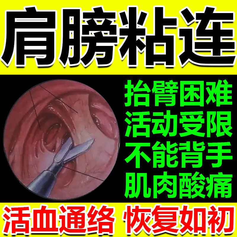 肩袖粘连抬臂困难肩部防护用品