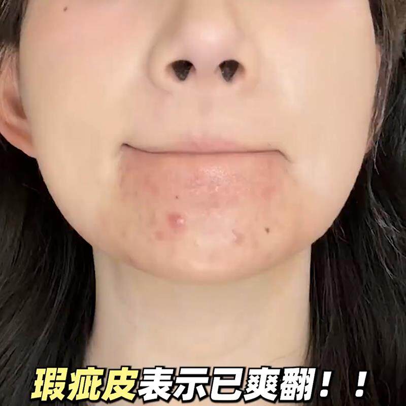 瑕疵皮救星！遮瑕膏遮暇液笔滋润不卡粉遮盖斑点脸部黑眼圈痘印