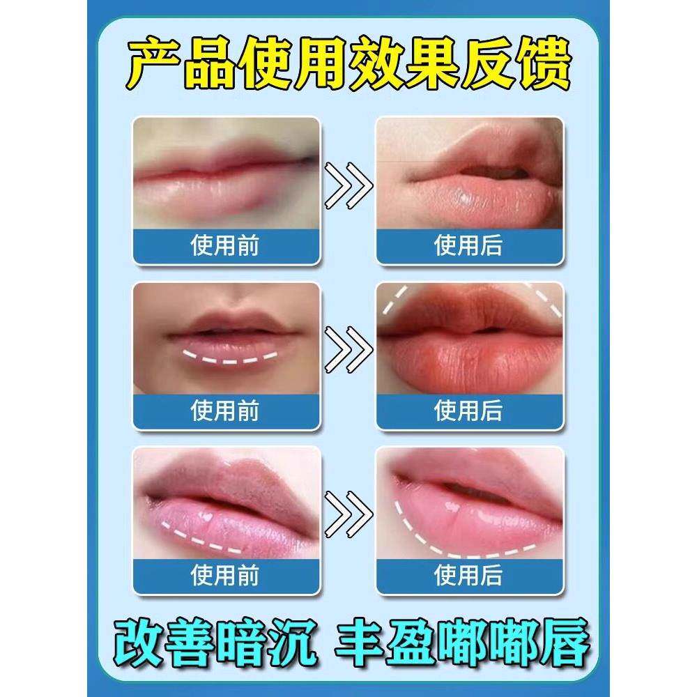 丰唇神器嘟嘟唇嘴干起皮裂口子水润丰唇塑形淡化唇纹嘴唇变厚软膏