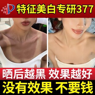 太阳晒黑修复变白快速美白专用皮肤身体脖子军训晒伤了晒后修复霜