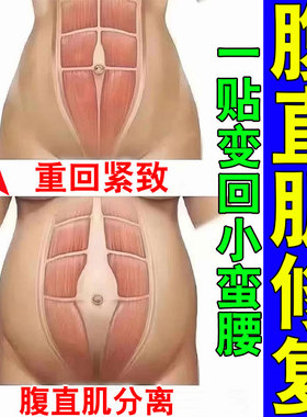 腹直肌分离修复仪贴矫正盆底肌产后肚子小腹凸出肚子松弛收胯神器