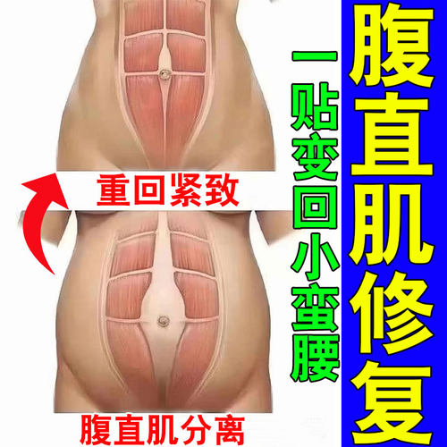 腹直肌分离修复仪贴矫正盆底肌产后肚子小腹凸出肚子松弛收胯神器