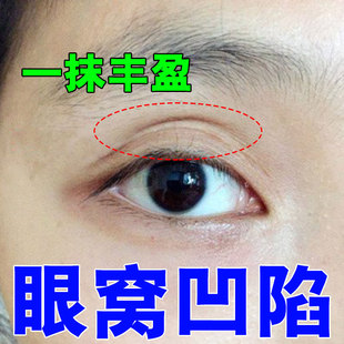 眼窝凹陷修复神器去除泪沟神器改善双眼皮松弛下垂提拉紧致用眼霜