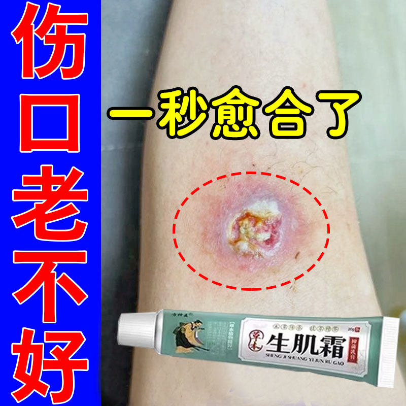 伤口愈合快速结痂溃烂促进长肉不留疤生肌长肉修复创口专用生肌霜