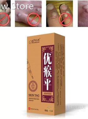 Body-Warts-Removal-Cream Skin-Tag-Remover Foot-Care 5ML 1-Bo