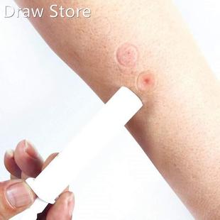 Mosquito Bites Itching Instant Bug Bite Relief Extraction Va