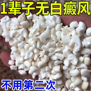 速发白癜风药 裉冶天黑色素生长非遮盖液外用白斑净膏RL