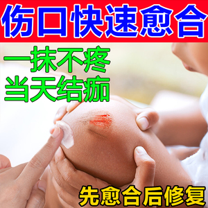 擦伤药膏儿童摔伤破皮药膝盖擦伤皮肤破损伤口消炎修复快速愈合药