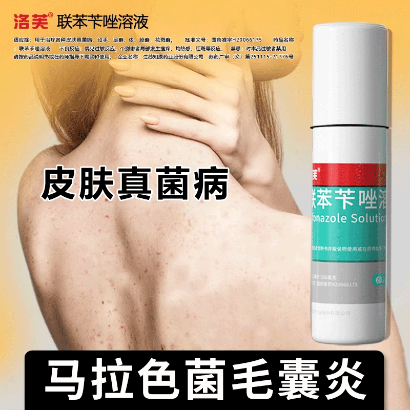 【洛芙】联苯苄唑溶液25ml250mg*50ml*1瓶/盒