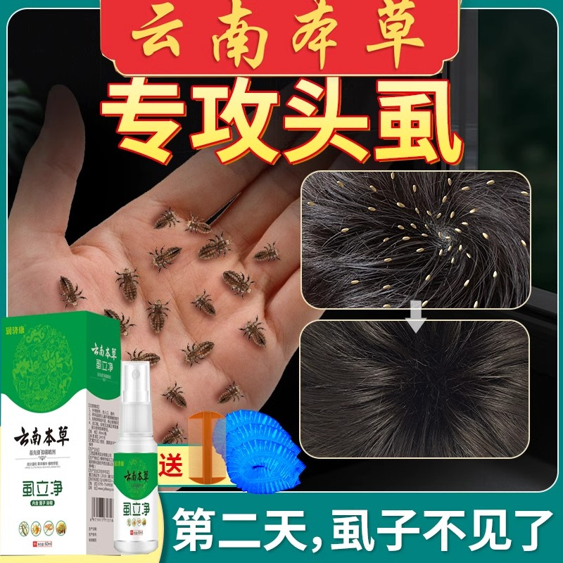 虱子药小女孩头发虱立净去除虱卵儿童头上长虱子的药百部酊灭头虱