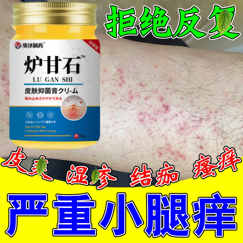 腿痒小腿皮肤干燥瘙痒起小红点疙瘩春夏天热治疗腿痒止痒抑菌膏药
