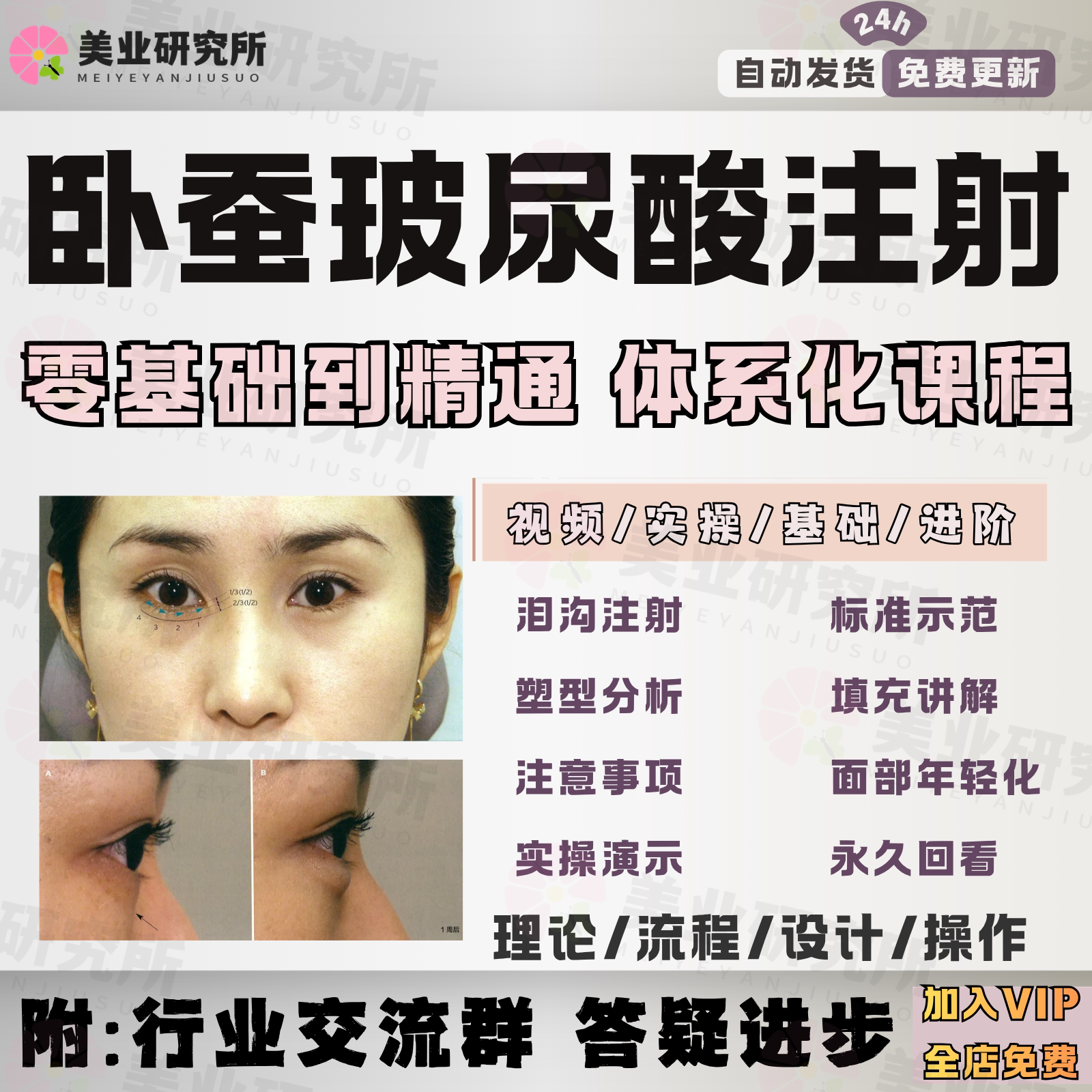 玻尿酸丰卧蚕填充注射泪沟桃花眼幼眼针剂年轻化注射医美教程视频