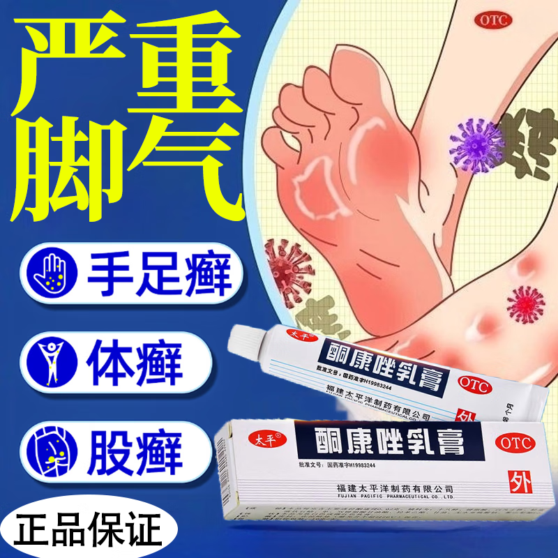 【太平】酮康唑乳膏2%*10g*1支/盒手癣足癣股癣体癣花斑癣