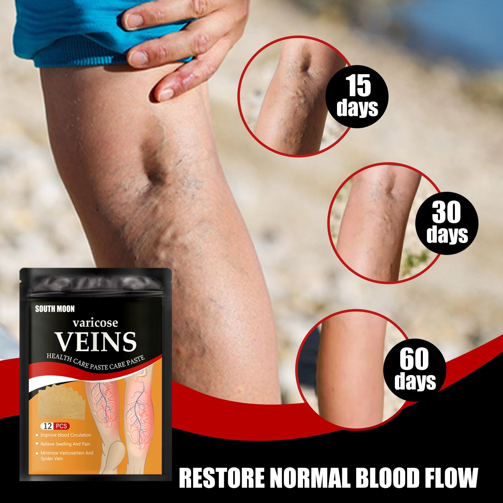 South Moon Leg Care Patch - Gentle Care Patch for Calf Veins