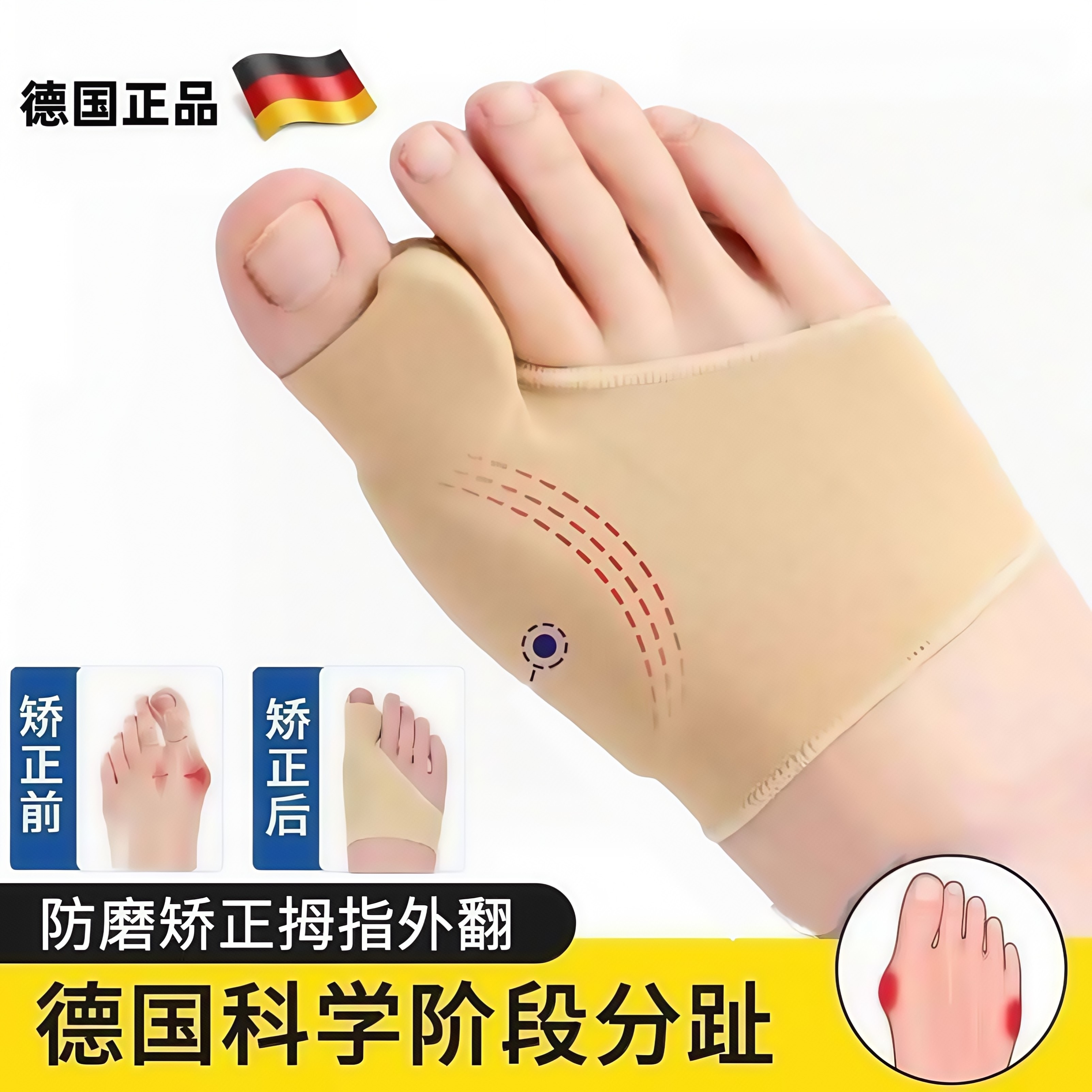 可穿鞋指套矫正德国品牌脚趾矫正器分趾器脚趾防磨拇指外翻矫正器