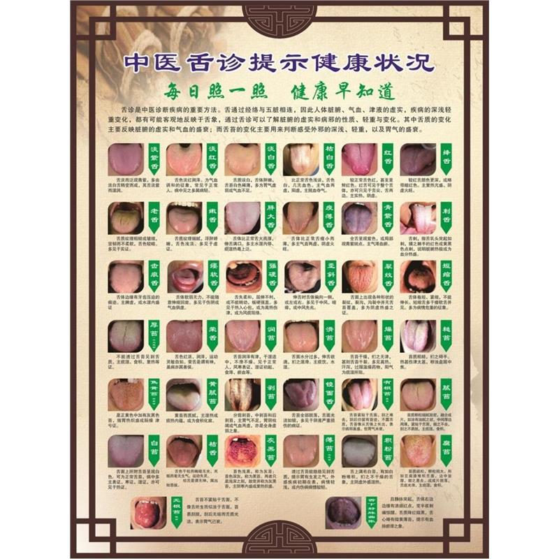 舌诊挂图舌诊辩证图解海报舌诊健康状况对照图中医诊所医院贴画