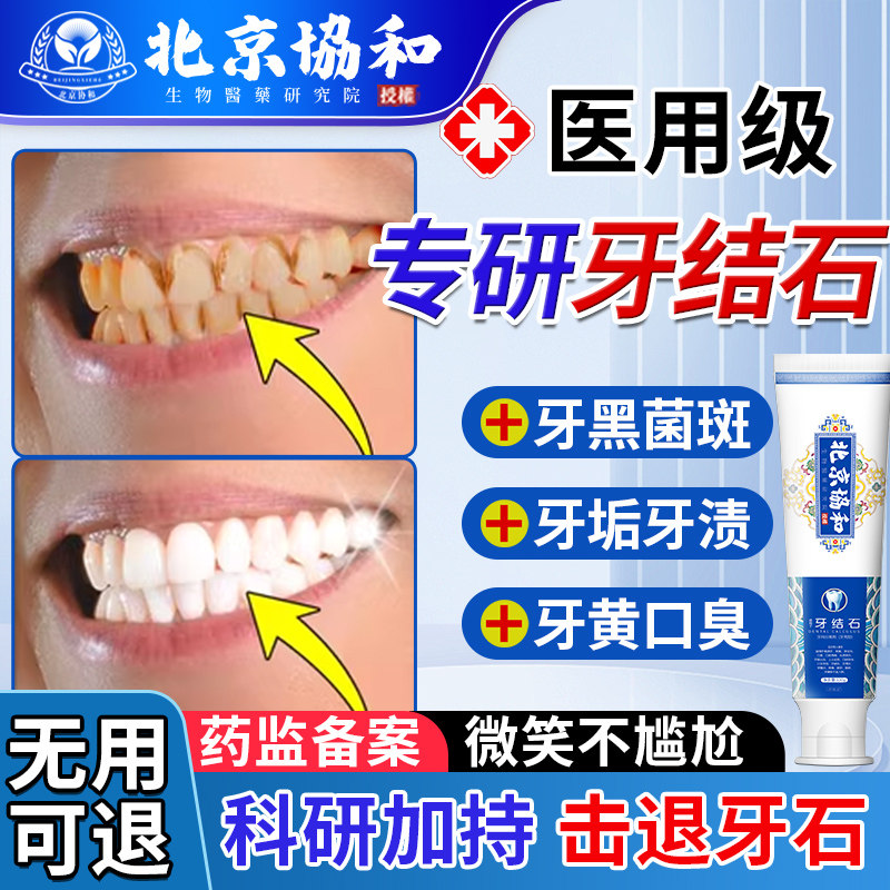 溶解牙结石医用去除牙渍牙黄牙龈口臭预防牙疼抗敏美白牙膏神器TI