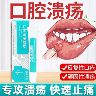 医用口腔溃疡凝胶专用一点灵儿童防反复上火舌头口腔起泡非喷雾剂