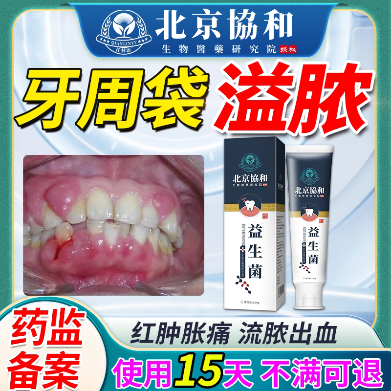牙周袋溢脓牙膏牙周脓肿牙周炎牙龈红肿胀痛牙龈出血牙龈炎牙疼OQ