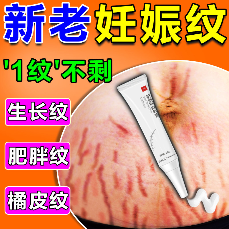妊娠纹修复霜疤痕修复除疤膏去生长纹肥胖纹药膏孕妇产后淡化消除