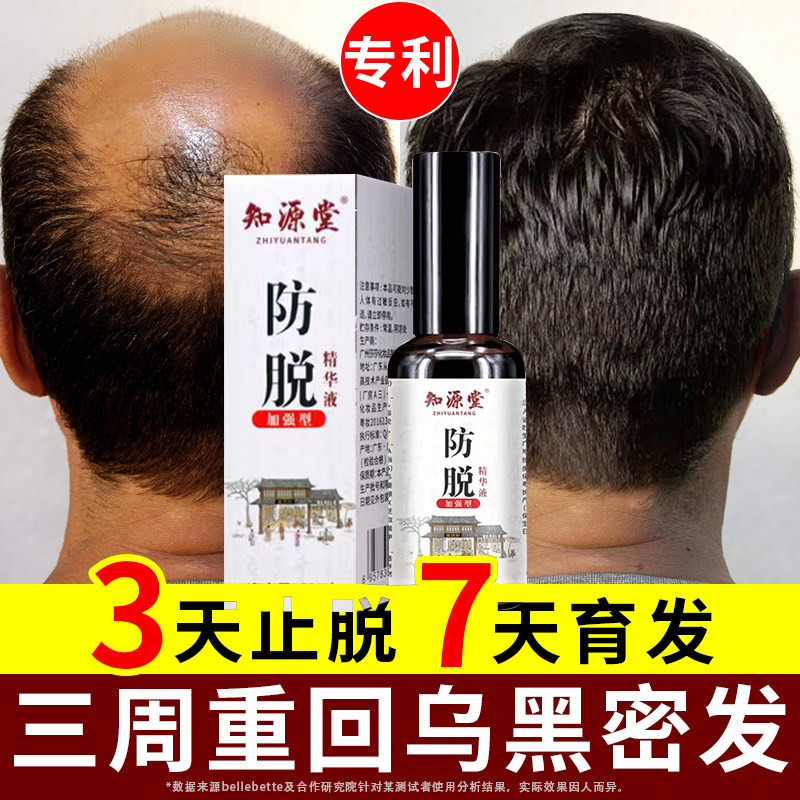 非那雄胺 浦立宁片非纳雄胺片脱发严重男专用菲那安雄片治疗脱发