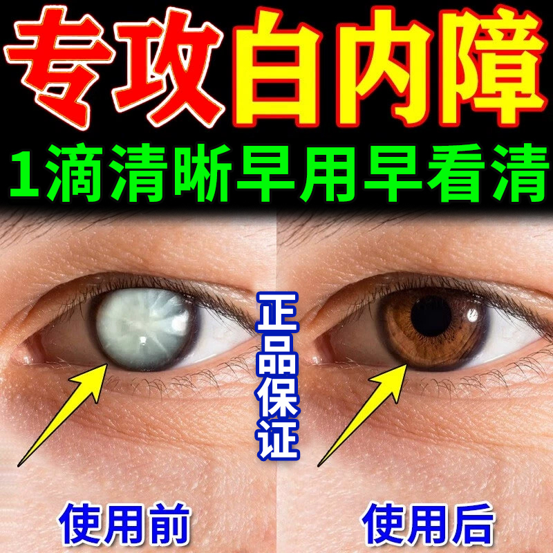 盐酸洛美沙星滴眼液眼睛红肿麦粒肿角膜炎眼部感染细菌性结膜炎