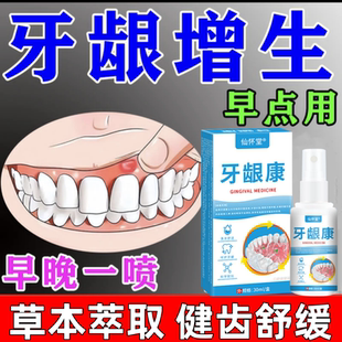 牙龈长脓包肿痛消焱喷雾剂牙周根发焱牙肉增生长鼓包止痛专用药水