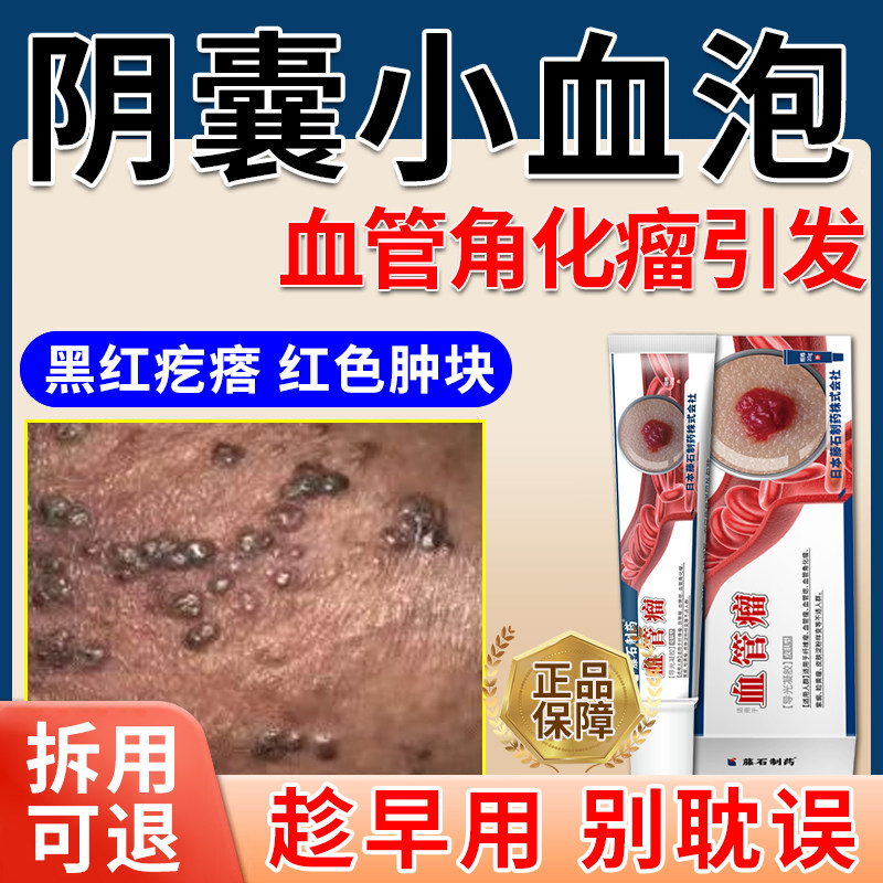 男士阴囊角化血管瘤毛细血管痣可搭去除药膏蜘蛛痣红斑湿疹肿块v5