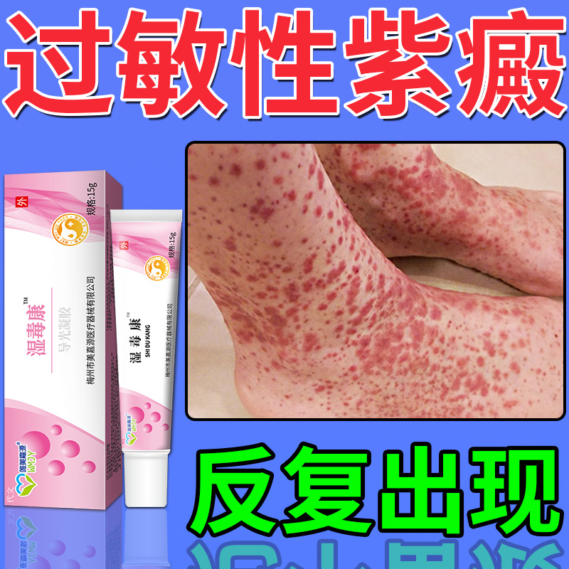 过敏性紫癜可搭配治疗仪皮下出血红点瘀滞药房同款膏皮炎血管炎lg
