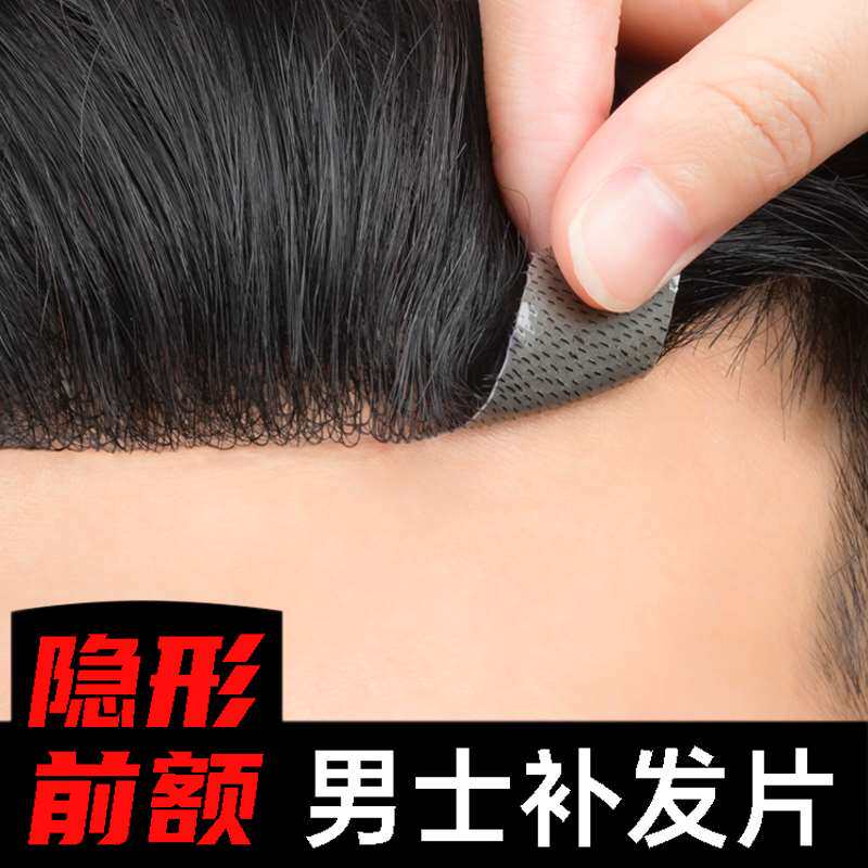 许昌假发发量增多神器男士发际线前额头假发片补发遮秃顶假刘海片