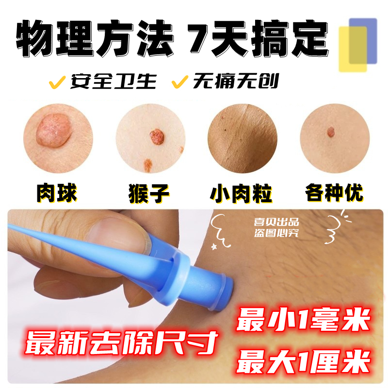 物理去除各种瘊子肉粒疙瘩丝状疣