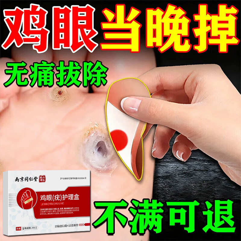 南京同仁堂鸡眼贴膏去跖疣除老茧根官方正品旗舰店脚底肉刺水杨酸