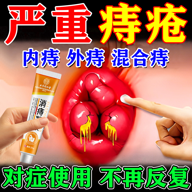 北京同仁堂痔疮凝胶痔疮膏消肉球去除器正品内外排行榜官方旗舰店