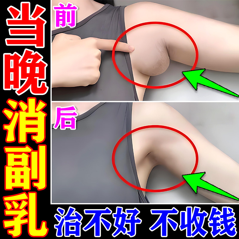 副乳消贴去副乳神器【最除慢3天收副乳】腋下淋巴疏通专用膏药贴